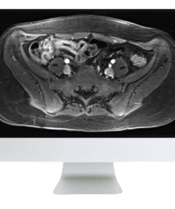 A Guide to Bowel Imaging