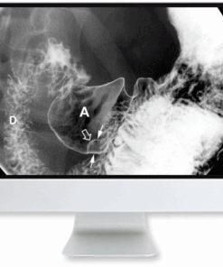 Clinical Case-Based Review of Abdominal Imaging