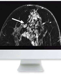 Clinical Case-Based Review of Breast Imaging