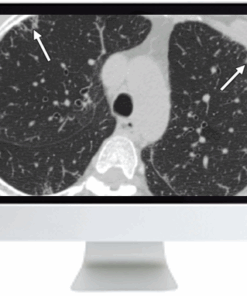 Clinical Case-Based Review of Cardiopulmonary Imaging