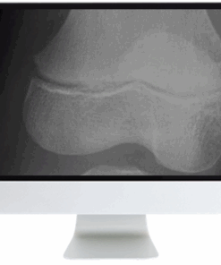 Clinical Case-Based Review of Musculoskeletal Imaging