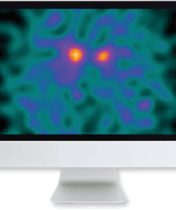 Clinical Case-Based Review of Nuclear Medicine
