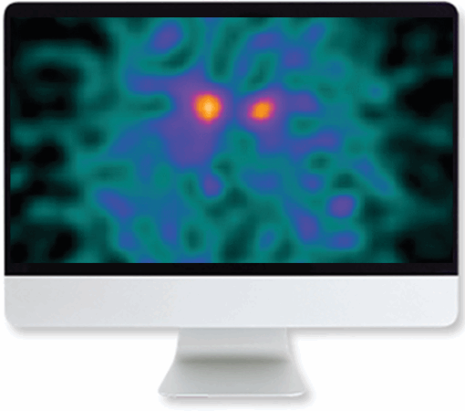 Clinical Case-Based Review of Nuclear Medicine