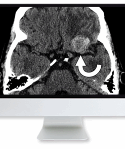 Clinical Case-Based Review of Neuroradiology