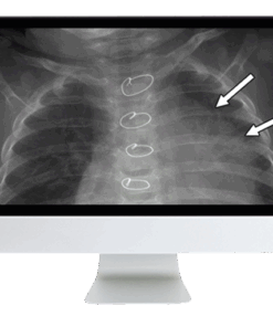 Clinical Case-Based Review of Pediatric Imaging