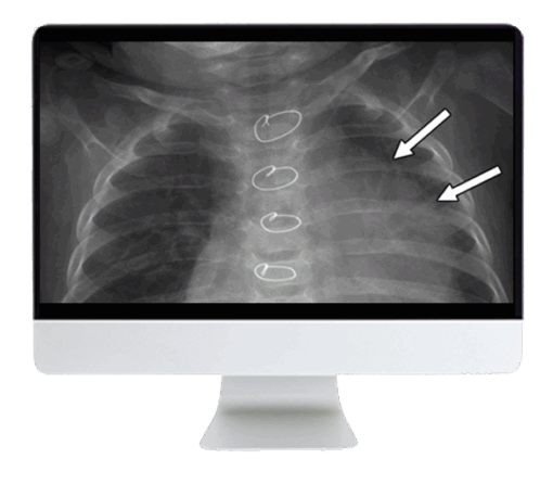 Clinical Case-Based Review of Pediatric Imaging