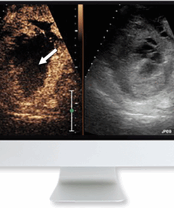 Clinical Case-Based Review of Ultrasound
