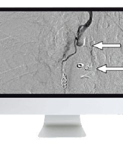 Clinical Case-Based Review of Vascular and Interventional Imaging