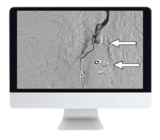 Clinical Case-Based Review of Vascular and Interventional Imaging