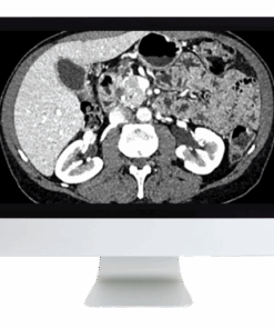 Gastrointestinal Imaging