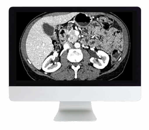 Gastrointestinal Imaging