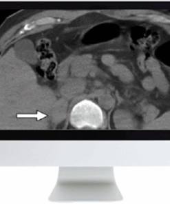 Male Genitourinary Imaging: From Anatomy to Oncology