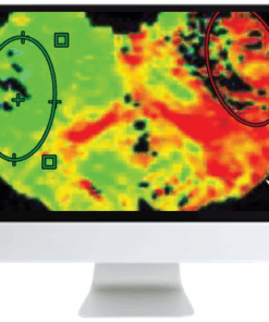 Code Stroke: What the Radiologist Needs to Know in the Changing Landscape of Acute Ischemic Stroke