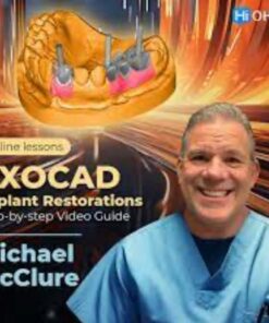 OHI-S EXOCAD Implant Restorations: Step-by-step Video Guide 2023