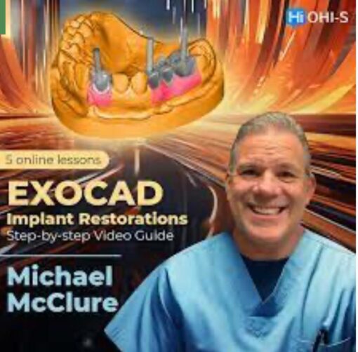OHI-S EXOCAD Implant Restorations: Step-by-step Video Guide 2023