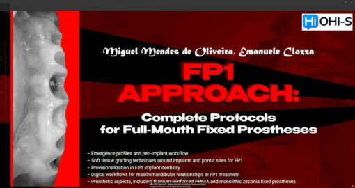 OHI-S FP1 Approach - Miguel Mendes de Oliveira, Emanuele Clozza Complete Protocols for Full-Mouth Fixed Prostheses