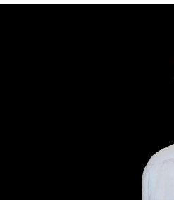 OHI-S Full-Mouth Rehabilitation Based on Implants and Natural Teeth - Giacomo Fabbri