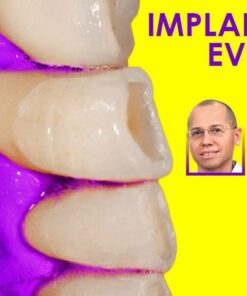 OHI-S  Implant-Perio Evolution: course of 10 webinars of implantology and periodontology