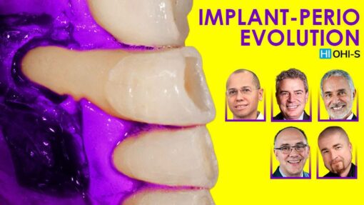 OHI-S  Implant-Perio Evolution: course of 10 webinars of implantology and periodontology