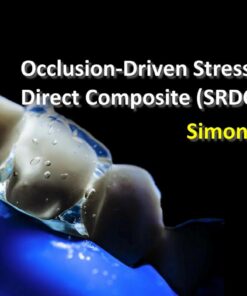 OHI-S Occlusion-Driven Stress-Reduced Direct Composite (SRDC) - Simone Deliperi