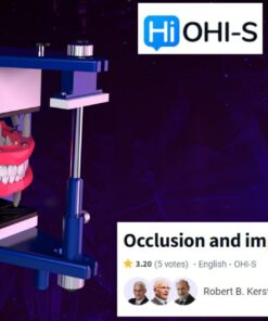 OHI-S Occlusion and Implants - Robert B. Kerstein, Jean Daniel Orthlieb, Martin Gross