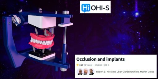 OHI-S Occlusion and Implants - Robert B. Kerstein, Jean Daniel Orthlieb, Martin Gross