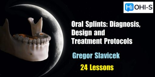 OHI-S Oral Splints: Diagnosis, Design and Treatment Protocols - Gregor Slavicek
