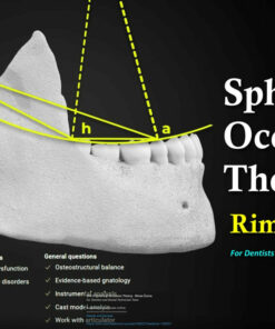 OHI-S Spherical Occlusion Theory - Rimas Šurna For Dentists and Dental Technician Team
