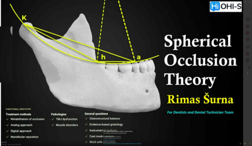 OHI-S Spherical Occlusion Theory - Rimas Šurna For Dentists and Dental Technician Team