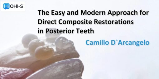 OHI-S The Easy and Modern Approach for Direct Composite Restorations in Posterior Teeth - Camilo D'Arcangelo