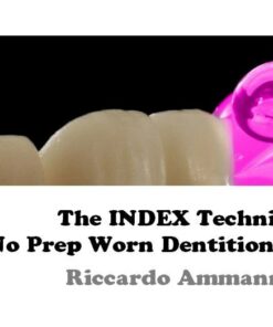 OHI-S The INDEX Technique, No Prep Worn Dentition Treatment - Ricardo Ammannato