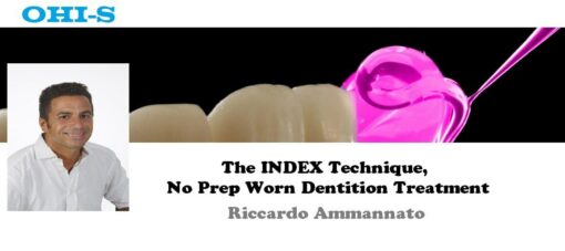 OHI-S The INDEX Technique, No Prep Worn Dentition Treatment - Ricardo Ammannato