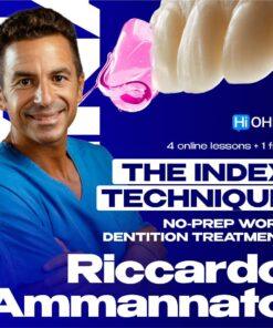 OHI-S - The Index Technique - No Prep Worn Dentition Treatment - Riccardo Ammannato