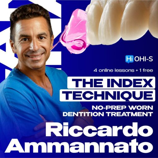 OHI-S - The Index Technique - No Prep Worn Dentition Treatment - Riccardo Ammannato