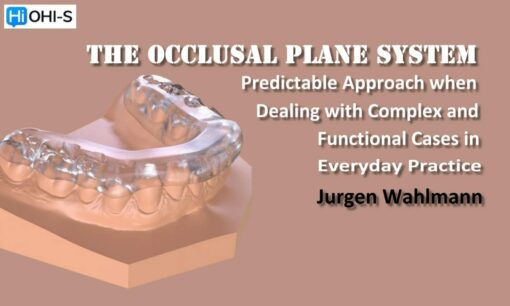OHI-S The Occlusal Plane System - Jurgen Wahlmann predictable approach when dealing with complex and functional cases in everyday practice