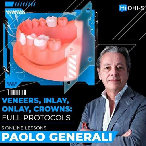OHI-S - Veneers, Inlay, Onlay, Crowns: Full Protocols - Paolo Generali