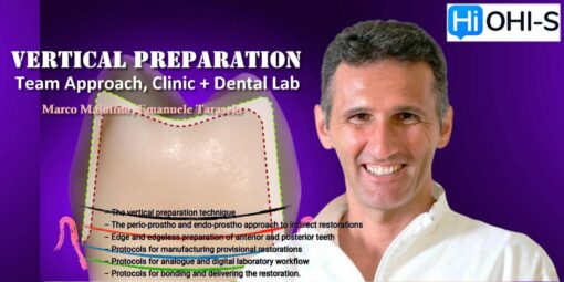 OHI-S Vertical Preparation: Team Approach, Clinic+Dental Lab