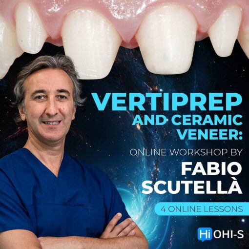 VertiPrep and Ceramic veneers: online workshop by Fabio Scutella