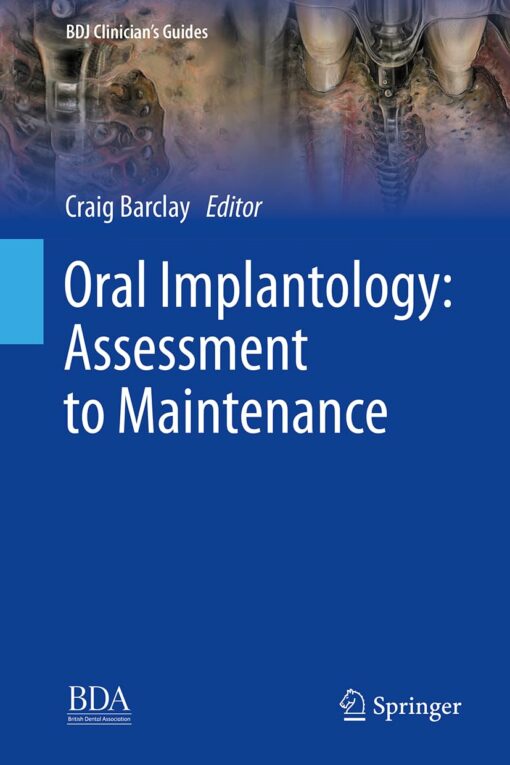 Oral Implantology: Assessment to Maintenance (BDJ Clinician’s Guides) 2024th Edition PDF