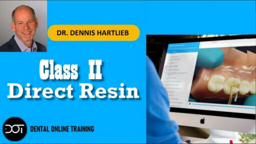 DOT Class II Direct Resin - Dennis Hartlieb