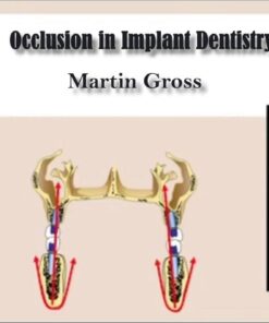 Occlusion in Implant Dentistry - Martin Gross