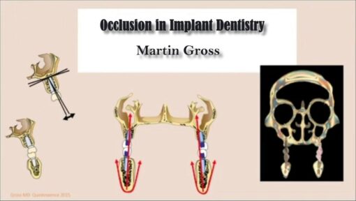 Occlusion in Implant Dentistry - Martin Gross