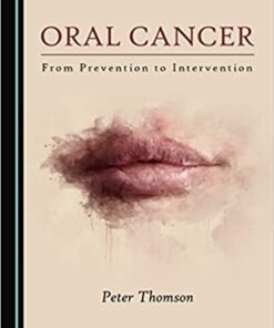 Oral Cancer 1st Edition PDF Original  by Peter Thomson (Author)