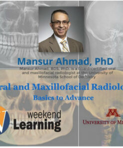 Oral and Maxillofacial Radiology: Basics to Advanced