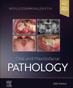 Oral and Maxillofacial Pathology 5th Edition PDF 