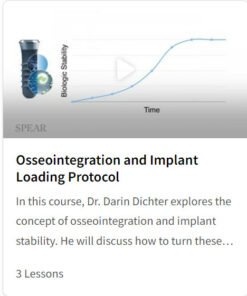 Osseointegration and Implant Loading Protocol