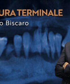 Osteocom Dentatura Terminale - Leonello Biscaro Guida alla transizione verso la protesi a supporto implantare (Italiano)
