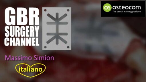 Osteocom GBR Surgery Channel - Massimo Simion (italiano) 