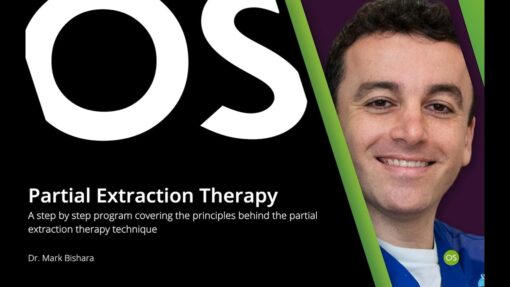 Osteocom Partial Extraction Therapy - Mark Bishara
