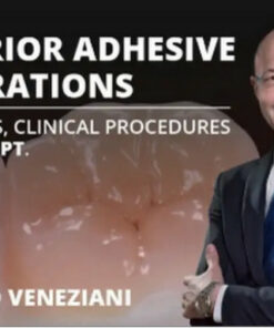 Osteocom Posterior Adhesive Restorations: Indications, Clinical Procedures and mDPT Techniques / Marco Veneziani